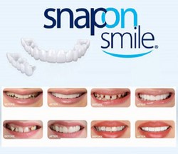 Răng giả Snap on smile